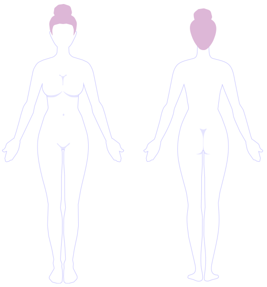 Laserontharen voor vrouwen